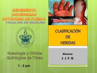 CLASIFICACIÓN
DE
HERIDAS
Alumno:
J. J. F. G.
1 - 2 pm
 