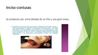 Inciso-contusas
Se producen por arma dotada de un filo y una gran masa.
 