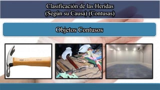 Clasificación de las Heridas
(Según su Causa) (Contusas)
Objetos Contusos
 