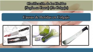 Clasificación de las Heridas
(Según su Causa) (En Colgajo)
Causas de Heridas en Colgajo
 