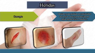 Heridas
Concepto
Herida es una pérdida de continuidad
de la piel o mucosa producida por
algún agente físico o químico.
 