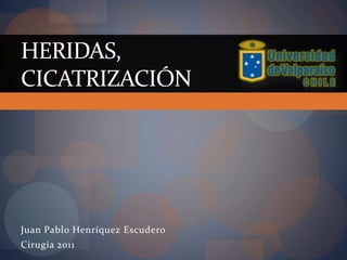 HERIDAS,
CICATRIZACIÓN




Juan Pablo Henríquez Escudero
Cirugía 2011
 