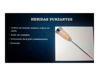 Heridas cortantes 
