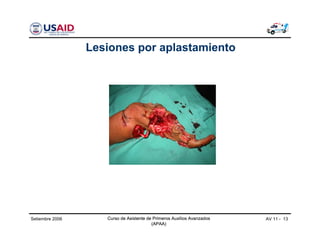 Curso de Asistente de Primeros Auxilios Avanzados
(APAA)
AV 11 - 13Curso de Asistente de Primeros Auxilios Avanzados
(APAA)
Setiembre 2006 Curso de Asistente de Primeros Auxilios Avanzados
(APAA)
Lesiones por aplastamiento
 