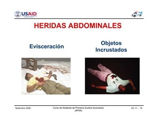 Curso de Asistente de Primeros Auxilios Avanzados
(APAA)
AV 11 - 19Curso de Asistente de Primeros Auxilios Avanzados
(APAA)
Setiembre 2006 Curso de Asistente de Primeros Auxilios Avanzados
(APAA)
Evisceración
Objetos
Incrustados
HERIDAS ABDOMINALES
 