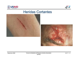 Curso de Asistente de Primeros Auxilios Avanzados
(APAA)
AV 11 - 9Curso de Asistente de Primeros Auxilios Avanzados
(APAA)
Setiembre 2006 Curso de Asistente de Primeros Auxilios Avanzados
(APAA)
Heridas Cortantes
 