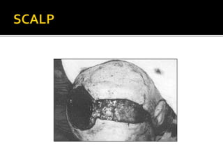 SCALP
