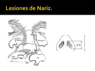 Lesiones de Nariz.
