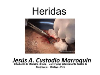 Heridas



Jesús A. Custodio Marroquín
Estudiante de Medicina IX Ciclo – Universidad Católica Santo Toribio de
                    Mogrovejo – Chiclayo - Perú
 