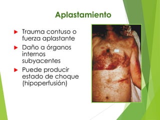 Aplastamiento
Trauma contuso o
fuerza aplastante
 Daño a órganos
internos
subyacentes
 Puede producir
estado de choque
(hipoperfusión)


 