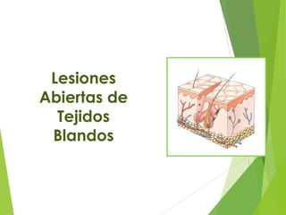 Lesiones
Abiertas de
Tejidos
Blandos

 