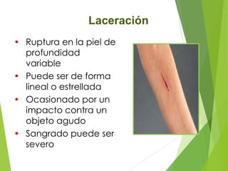 Laceración
• Ruptura en la piel de
profundidad
variable
• Puede ser de forma
lineal o estrellada
• Ocasionado por un
impacto contra un
objeto agudo
• Sangrado puede ser
severo

 