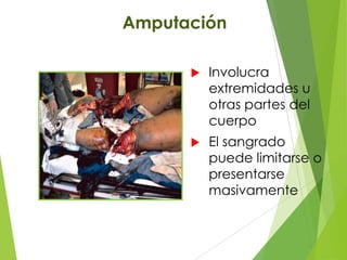 Amputación


Involucra
extremidades u
otras partes del
cuerpo



El sangrado
puede limitarse o
presentarse
masivamente

 