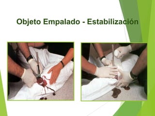 Objeto Empalado - Estabilización

 