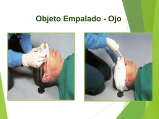 Objeto Empalado - Ojo

 