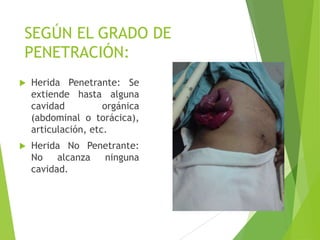SEGÚN EL GRADO DE
PENETRACIÓN:


Herida Penetrante: Se
extiende hasta alguna
cavidad
orgánica
(abdominal o torácica),
articulación, etc.



Herida No Penetrante:
No
alcanza
ninguna
cavidad.

 