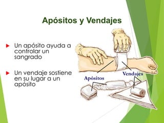 Apósitos y Vendajes


Un apósito ayuda a
controlar un
sangrado



Un vendaje sostiene
en su lugar a un
apósito

Apósitos

Vendajes

 