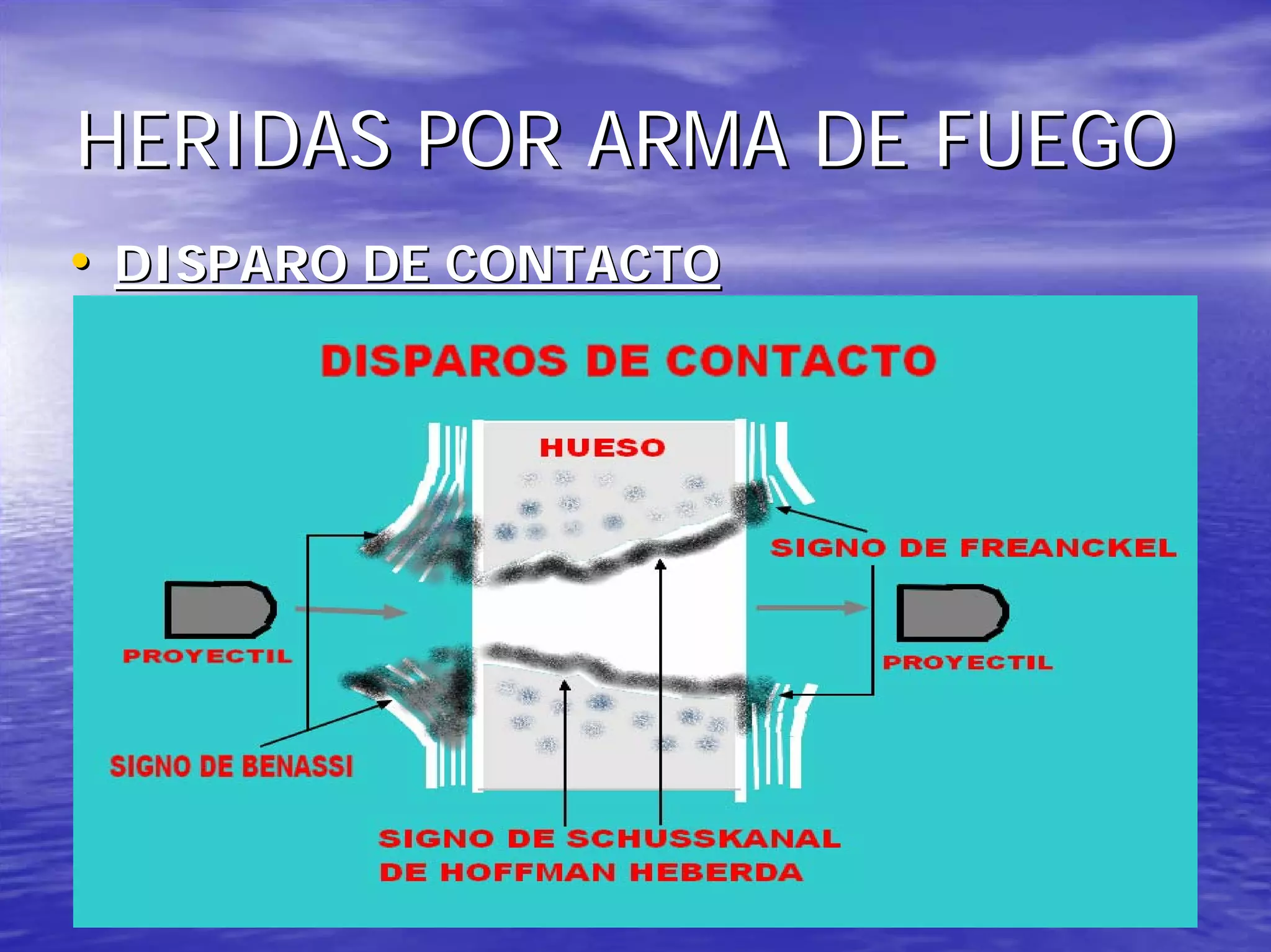 Heridas por arma de fuego | PDF
