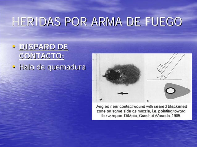 Heridas por arma de fuego | PDF