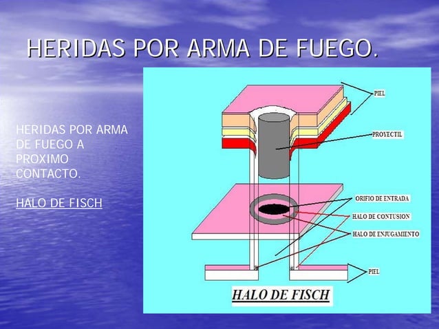 Heridas por arma de fuego | PDF