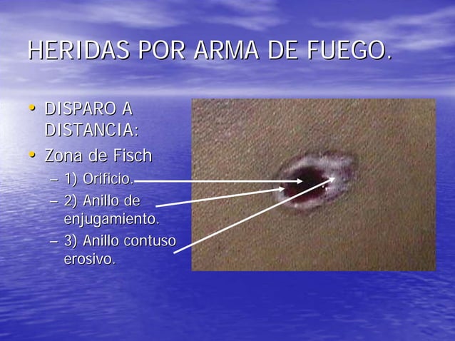 Heridas por arma de fuego | PDF