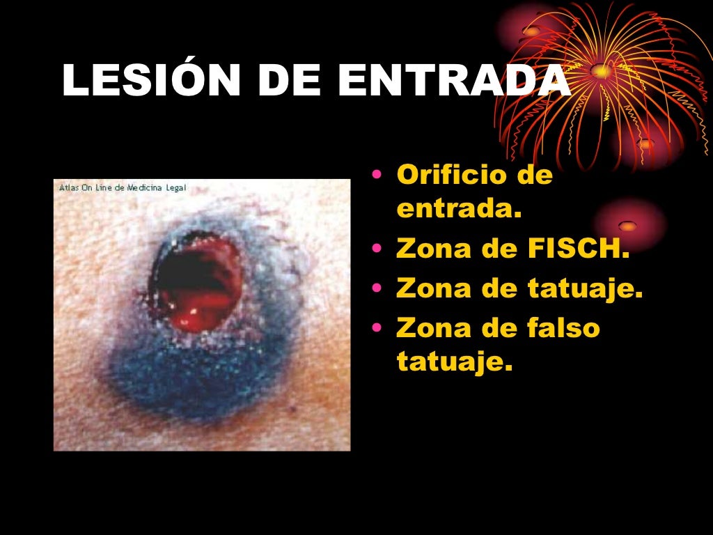 Heridas por arma de fuego Heridas por arma de fuego