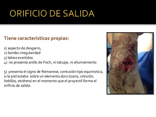 Heridas por arma de fuego traumatologia
