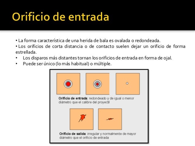Orificio De Entrada Por Arma De Fuego www.slideshare.net