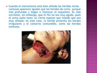 Cuando el instrumento está bien afilado las heridas inciso – contusas aparecen iguales que las heridas de corte, aunque más profundas y llagan a interesar el esqueleto. Es más corriente, sin embargo, que el filo no sea muy agudo, pues el arma suele tener un cierto espesor que impide que sea muy afilada; en este caso, la herida presenta los bordes irregulares y el contorno contundido, como las heridas contusas. 