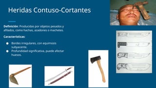 Medicina Lagal - HERIDAS POR ARMAS BLANCAS.pptx
