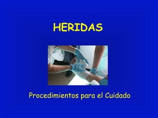 HERIDAS 
Procedimientos para el Cuidado 
 