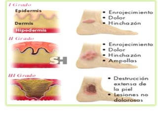 Heridas punzo penetrantes.edgar