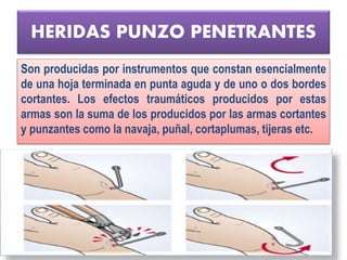 HERIDAS PUNZO PENETRANTES
Son producidas por instrumentos que constan esencialmente
de una hoja terminada en punta aguda y de uno o dos bordes
cortantes. Los efectos traumáticos producidos por estas
armas son la suma de los producidos por las armas cortantes
y punzantes como la navaja, puñal, cortaplumas, tijeras etc.
 