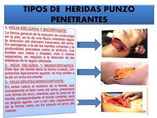 TIPOS DE HERIDAS PUNZO
PENETRANTES
 
