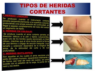TIPOS DE HERIDAS
CORTANTES
 