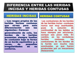 .- Los rasgos propios de las
heridas incisas contusas
que sirven para esta
diferenciación son las
siguientes : Carecen
generalmente de cola, los
bordes de la heridas
presentan siempre huellas
de contusión bajo la forma
de un borde equimótico y, a
veces, de pequeñas
irregularidades de su
contorno.
HERIDAS CONTUSAS
 