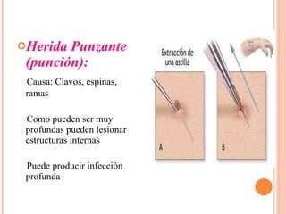 Herida Punzante (punción): Causa: Clavos, espinas, ramas Como pueden ser muy profundas pueden lesionar estructuras internas Puede producir infección profunda 
