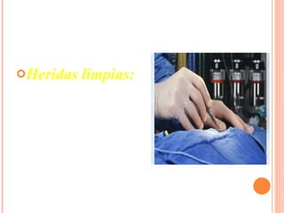 Heridas limpias: Aquellas que son realizadas en un medio controlado (quirófano) con material estéril, generalmente es realizada por un cirujano 