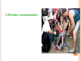 Heridas contaminadas: Herida que no se realiza dentro de un medio controlado ni con material estéril generalmente ocurren sin premeditación por parte del paciente 