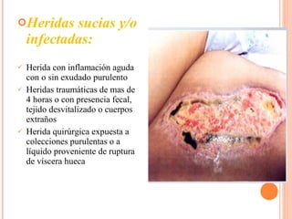 Heridas sucias y/o infectadas: Herida con inflamación aguda con o sin exudado purulento Heridas traumáticas de mas de 4 horas o con presencia fecal, tejido desvitalizado o cuerpos extraños Herida quirúrgica expuesta a colecciones purulentas o a líquido proveniente de ruptura de víscera hueca 