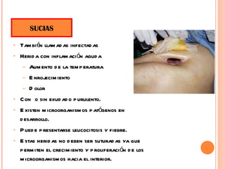 También llamadas infectadas Herida con inflamación aguda  Aumento de la temperatura Enrojecimiento Dolor Con  o sin exudado purulento. Existen microorganismos patógenos en desarrollo. Puede presentarse leucocitosis y fiebre. Estas heridas no deben ser suturadas ya que permiten el crecimiento y proliferación de los microorganismos hacia el interior. SUCIAS 