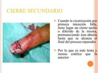 Cuando la cicatrización por primera intención falla, tiene lugar un cierre tardío o diferido de la misma, permaneciendo ésta abierta hasta que se alcanza el final del proceso reparador Por lo que es más lenta y menos estética que la anterior CIERRE SECUNDARIO 