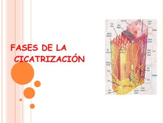 FASES DE LA  CICATRIZACIÓN 