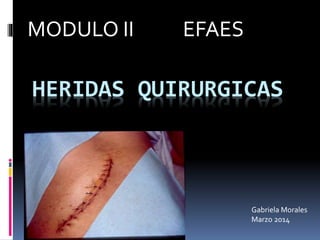 HERIDAS QUIRURGICAS
MODULO II EFAES
Gabriela Morales
Marzo 2014
 