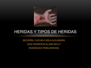 HERIDAS Y TIPOS DE HERIDAS
   BECERRIL CUEVAS CARLA ALEJANDRA
      DIAZ HERREROS ALAMA NELLY
       RODRIGUEZ PEÑA ADRIANA
 