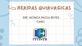 HERIDAS QUIRURGICAS
ENF. MONICA PAOLA REYES
CANO
 