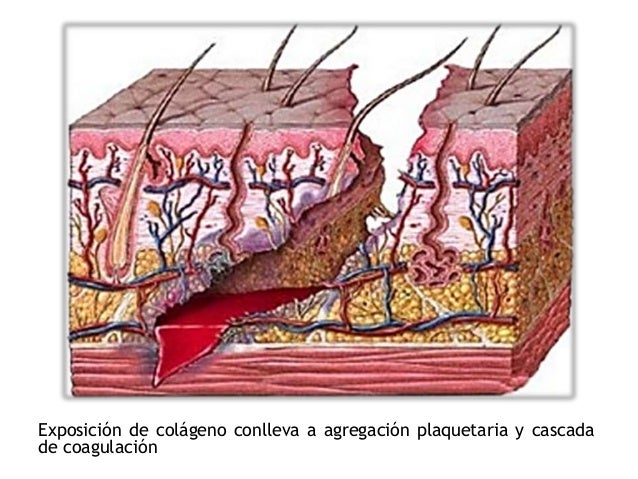 HERIDAS - PROCESO DE CICATRIZACIÓN