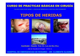 CURSO DE PRACTICAS BÁSICAS EN CIRUGÍA
     CASA DE LA EDUCACIÓN MEDICA – COLEGIO DE MÉDICOS DE LA SEGUNDA CIRCUNSCRIPCIÓN




              TIPOS DE HERIDAS




               Coordinador – Docente: Prof. Dr. Luis del Rio Diez
                         Jefe de Guardia de Cirugía – H.E.C.A.

HOSPITAL DE EMERGENCIAS DE ROSARIO – DR. CLEMENTE ÁLVAREZ
 
