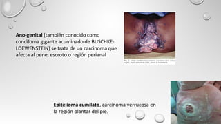 Epitelioma cumilato, carcinoma verrucosa en
la región plantar del pie.
Ano-genital (también conocido como
condiloma gigante acuminado de BUSCHKE-
LOEWENSTEIN) se trata de un carcinoma que
afecta al pene, escroto o región perianal
 