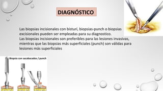 Las biopsias incisionales con bisturí, biopsias-punch o biopsias
excisionales pueden ser empleadas para su diagnostico.
Las biopsias incisionales son preferibles para las lesiones invasivas,
mientras que las biopsias más superficiales (punch) son válidas para
lesiones más superficiales
DIAGNÓSTICO
Biopsia con sacabacados / punch
 